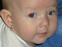 Výřez (R), 1/60 s, f/2.80, ISO: 64, 37.00 mm