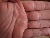 Pleťová barva | Jiří Beneš Pleťová barva